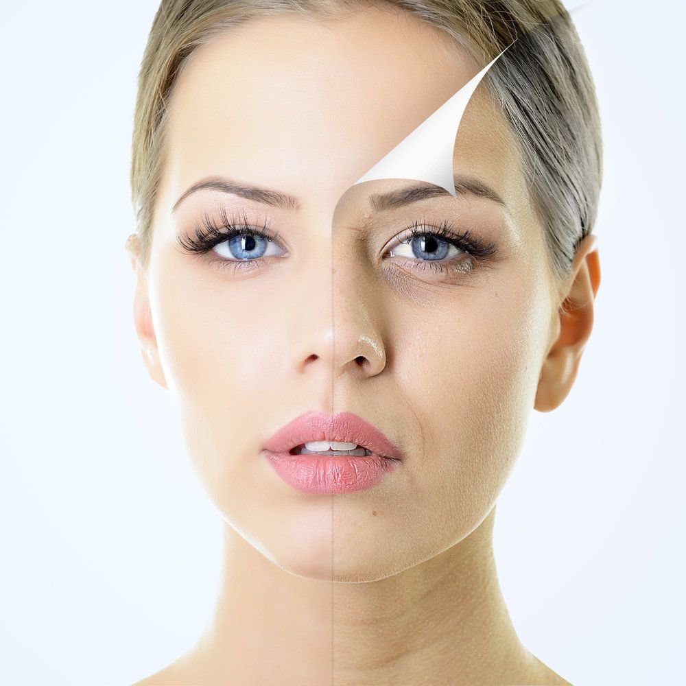 JUVEDERM in Fairfield County